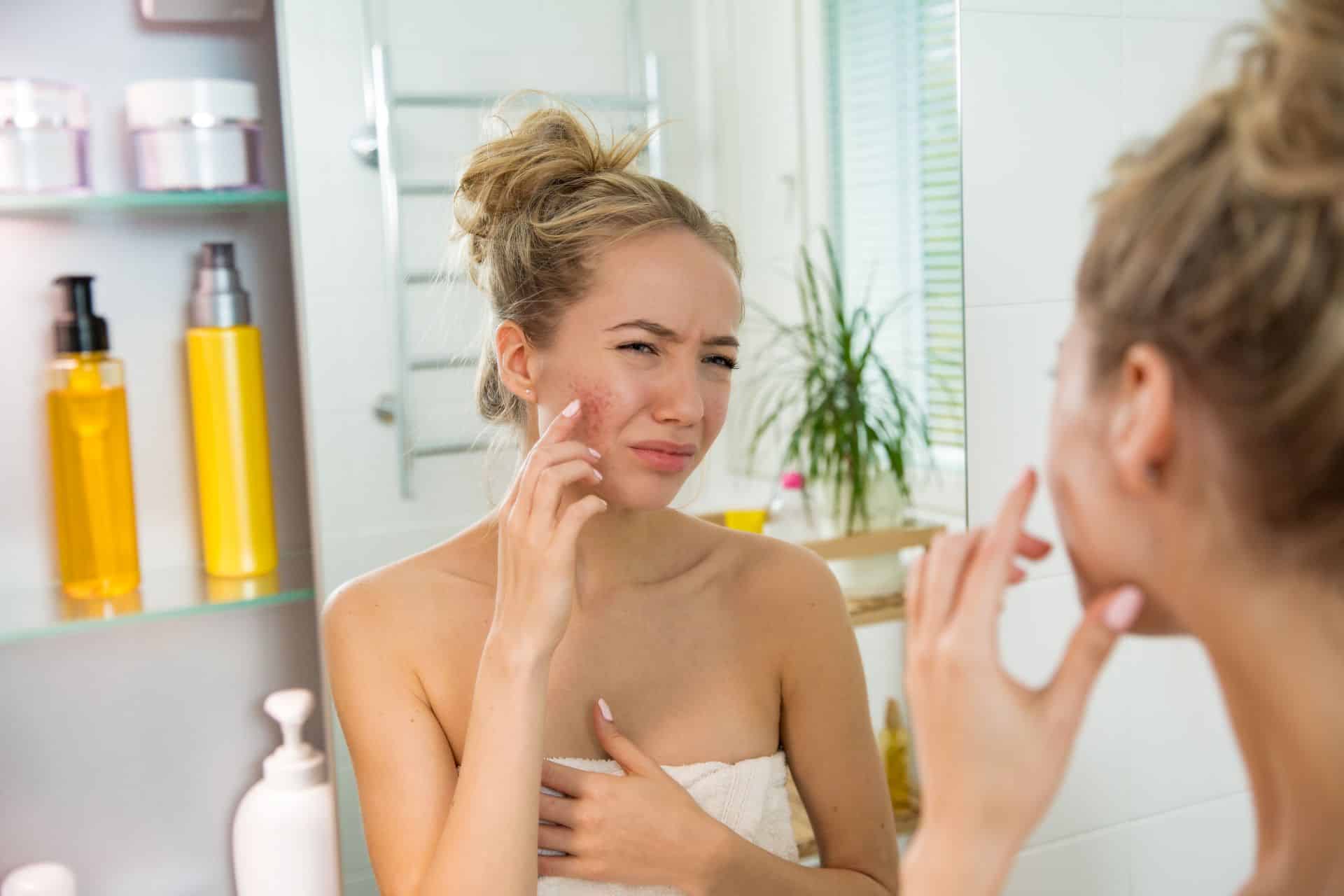  Frau mit geröteter Haut im Spiegel – Hautreaktion als moegliches Zeichen innerer Belastung - Alex Cosmetic